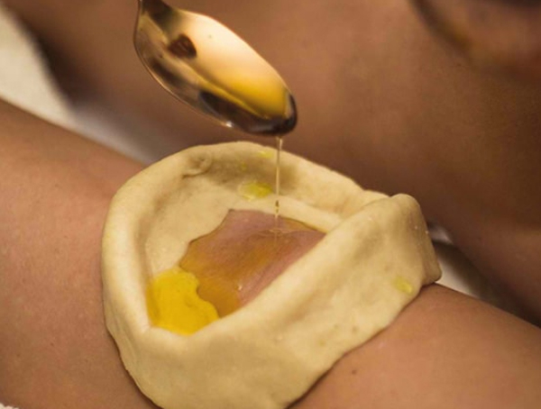 Arthritis Treatments