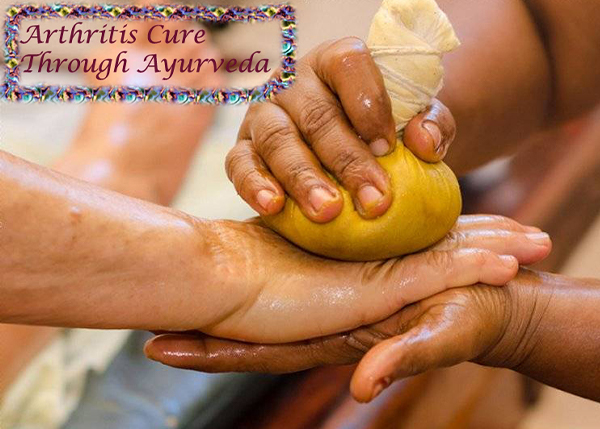 Arthritis Management